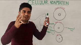 Cellular adaptation part 2  Atrophy and hypertrophy  by Dr aqib [upl. by Arrad566]