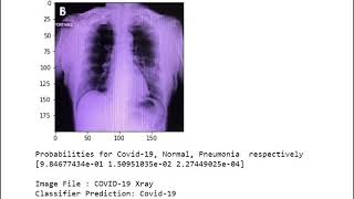 Covid 19 Classification Model  DenseNet121 [upl. by Emse823]