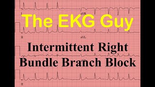 EKGECG  Intermittent Right Bundle Branch Block  Question 230  The EKG Guy [upl. by Ynettirb]