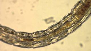 Chironomidae  A Midge Larvae [upl. by Atsedom]