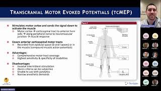 Intraoperative Neuromonitoring with Michael Pompliano MD on March 4 2024 [upl. by Karol]