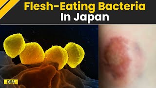 Deaths Happen Within 48 Hours Rare FleshEating Bacteria Spreads In Japan [upl. by Okihsoy533]