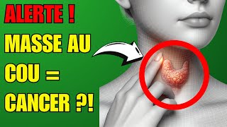 Jai Découvert Ces 5 Signes de Cancer de la Thyroïde à Ne Pas Ignorer  🚨✨ Prévention Santé [upl. by Eiblehs]