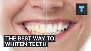 The best way to whiten teeth [upl. by Ignacius]