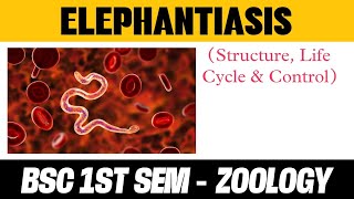 Elephantiasis Structure  life Cycle  Control Notes in Hindi  BSC 1 SEMESTER ZOOLOGY [upl. by Illene]