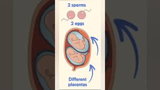 twins pregnancy baby conceive pregnancysigns viral [upl. by Axela946]