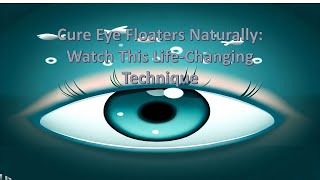 Cure Eye Floaters Naturally Watch This LifeChanging Technique [upl. by Derward]