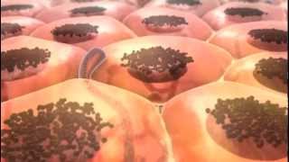 From Melanocyte to Melanoma [upl. by Noscire]