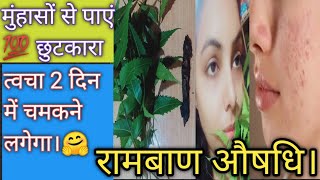 Neem ke es hise se kre pimpals thik🤗 चेहरा चमकने से कोई नहीं रोक सकता।👍 [upl. by Baillieu]