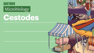 Cestodes Microbiology  USMLE Step 1  Sketchy Medical [upl. by Kevina]