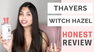 Thayers Witch Hazel Review Is it Worth the Hype  Social Nupur [upl. by Gnuy]