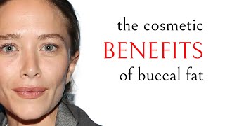 Cosmetic benefits of keeping buccal fat  Perioral Mounds  Jowls  Facial Sculpting with Dr Zelken [upl. by Buffo]