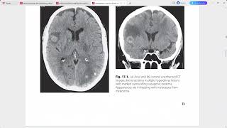 EMERGENCY CROSS SECTIONAL RADIOLOGY [upl. by Ephrayim]