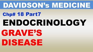 Davidsons Medicine Chp18 Part7  GRAVEs Disease  Endocrinology  Subclinical Thyroid Issues [upl. by Scully850]