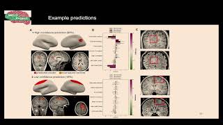 OHBM 2024  Educational Course  Precision surface imaging of the cerebral cortex  Part 10 [upl. by Esinert]