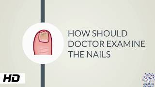 HOW AND WHY SHOULD DOCTOR EXAMINE THE NAILS [upl. by Einreb]