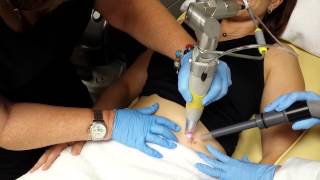 Laser Tattoo Removal Treatment  quotSunny Bubblesquot [upl. by Annaitat]