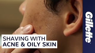 How to Shave with Acne and Oily Skin  Mens Skin Care Tips [upl. by Nairde]