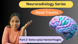 Extraaxial Hemorrhages  Head Trauma Part 2  Neuroradiodiology  Dr Somlina Dutta [upl. by Aiblis]