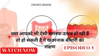 crohns disease symptoms and signs in hindi ep01 [upl. by Lzeil650]