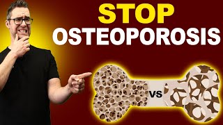 Top 7 Osteopenia amp Osteoporosis Treatments Symptoms amp Medications [upl. by Laura]