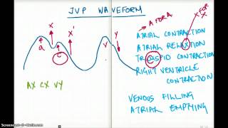 EASY WAYS TO REMEMBER JVP WAVEFORM [upl. by Ahsenre]