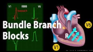 ECG part 10 Left amp right bundle branch block [upl. by Burlie]