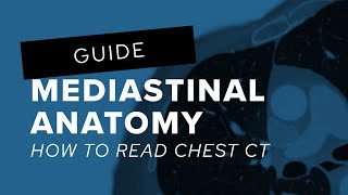 How to read chest CT mediastinal anatomy [upl. by Machos]