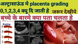 pregnancy ultrasound me placenta grade 01234 ka kya matlb hota he [upl. by Folger249]