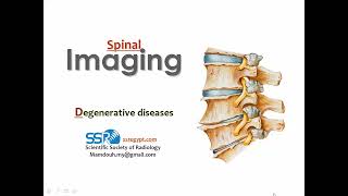 Spine Degenerative Diseases Imaging  Prof Mamdouh Mahfouz [upl. by Sisto178]