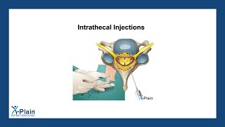 Intrathecal Injections [upl. by Jemina]