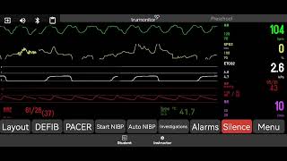 Pulseless Electrical Activity [upl. by Oiluarb]