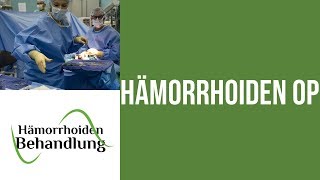 Hämorrhoiden OP  Welche Möglichkeiten gibt es für dich  Hämorrhoiden Operation [upl. by Eboh504]