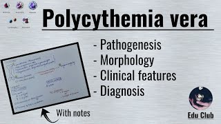 Polycythemia vera  Myeloproliferative Disorders  Pathology [upl. by Aiseneg]