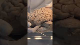 Brain generates electricity  shorts viral short [upl. by Nicko]