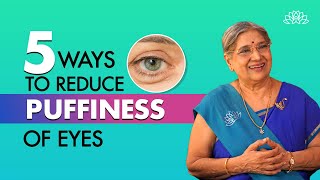 Home Remedies for Puffy Eyes I Treat puffy eyes naturally I Dr Hansaji [upl. by Mariette445]