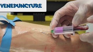 Venipuncture  How to take Blood  OSCE Guide old version  UKMLA  CPSA [upl. by Hgielrahc]