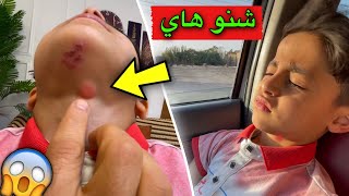 شي غربي طلع في رقبت يمان 😨 [upl. by Eirolav]