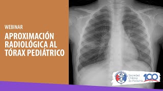 WEBINAR quotAPROXIMACIÓN RADIOLÓGICA AL TÓRAX PEDIÁTRICOquot [upl. by Ynnej]