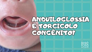 Existe relação entre anquiloglossia e torcicolo congênito RESPONDENDO PERGUNTAS [upl. by Nuahs]