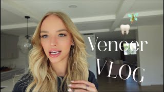 Mini veneer vlog 🦷🧚🏼 [upl. by Anni]