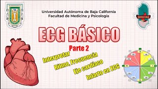 Aprende a interpretar ECG Básico Rápido y Sencillo  Parte 2  GUÍA RESUMIDA [upl. by Skiba]