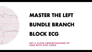 Master the Left Bundle Branch Block ECG Get a clear understanding of LBBB with our video [upl. by Austine722]