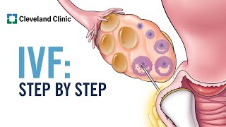 How Does In Vitro Fertilization IVF Work A StepbyStep Explanation [upl. by Hamachi]