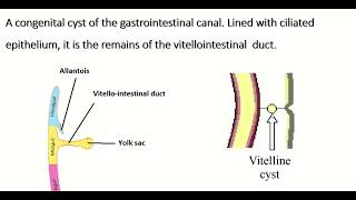 Embryology of vitellointestinal duct  formation fate amp congenital anomalies [upl. by Lorimer788]