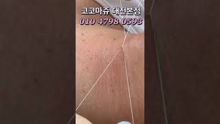 따꼼😂멀리서 와주신 호탕한 손님 깔끔하게 고민해결 해드렸어요👍 대전실면도 실면도 피부고민해결피부관리 실면도잘하는곳청주실면도전주실면도대구실면도천안실면도 [upl. by Lenora]