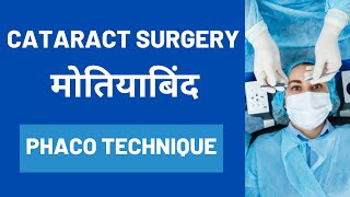 Cataract Surgeryमोतियाबिंद Advanced Phaco Technique and Lenses [upl. by Ahsanat413]