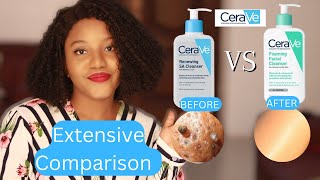 Which is best for your Acne Prone Skin Cerave SA Cleanser Vs Cerave Foaming Cleanser [upl. by Scevour286]