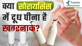 क्या सोरायसिस में दूध पीना है खतरनाक  Role of Milk in Psoriasis  Psoriasis Treatment India [upl. by Neehahs]