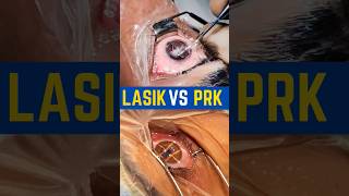 LASIK VS PRK [upl. by Gustafson]